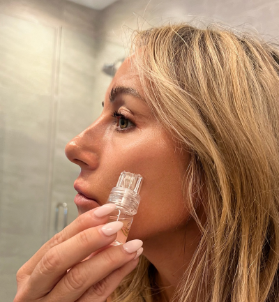 Million Dollar Micro-Infusion Kit