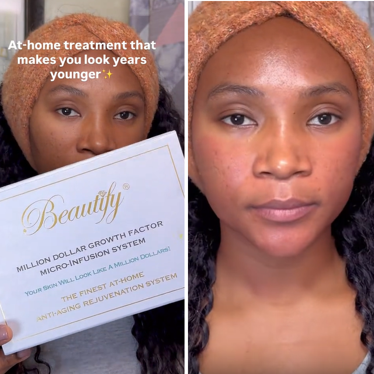 Beautify Micro-Infusion Kit